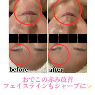 Beauty salonBellのエステ・リラクイメージ