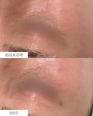 美の宝石屋さん gemme【ジェム】所属・gemme -ジェム-のエステ・リラクイメージ