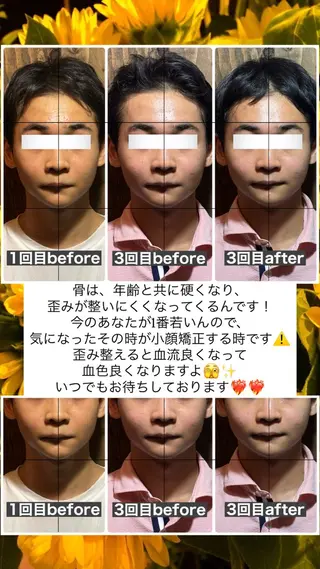 💎後悔させない小顔 矯正💎イトヤマ🌱のエステ・リラクイメージ