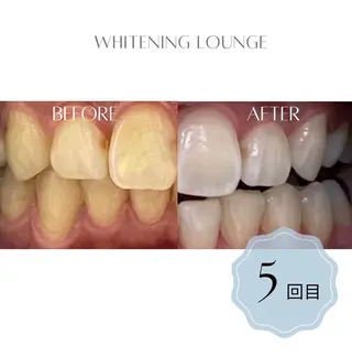 ホワイトニングラウンジ横須賀所属・ホワイトニング Lounge横須賀のその他イメージ