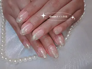ネイル フィルイン、長さ出し 深爪矯正のネイルデザイン