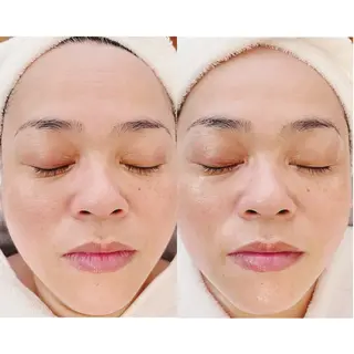 痩身/リンパマッサージ専門サロン　 MOA所属・エステサロンMOA (モア)のエステ・リラクイメージ