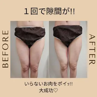 脂肪冷却・脱毛サロン coconoix のエステ・リラクイメージ