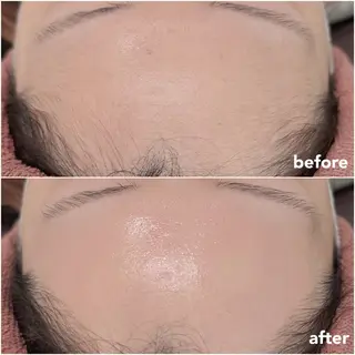 REVE （レーヴ）のマツエク・マツパデザイン