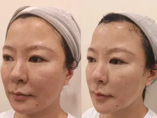 aliaハイフ&水光ジェットサロン所属・aliaハーブ水光店 エステティシャン募集のエステ・リラクイメージ