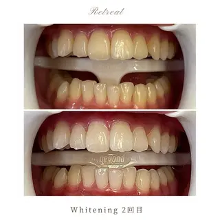 Retreatリトリート所属・歯科医院提携 Retreatのエステ・リラクイメージ