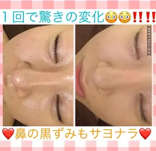 ミディアム カラー パーマ ヘアアレンジ メンズ キッズ ネイル マツエク・マツパ ニキビ・肌質改善専門 ♡人生が変わるサロンのエステ・リラクイメージ