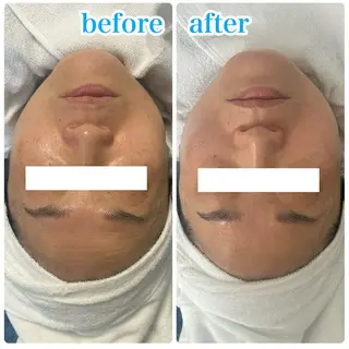 NARIS BEAUTY STATION デ･アイム札幌白石所属・高岸 利奈のエステ・リラクイメージ