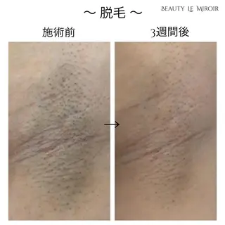 ビューティー ミロワールのエステ・リラクイメージ