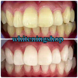 ホワイトニング ショップ吉祥寺店のエステ・リラクイメージ