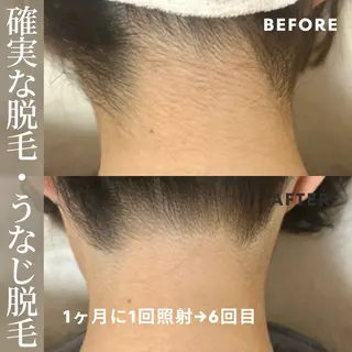 脱毛しま専科 宗右衛門町店のエステ・リラクイメージ