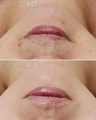 ALOHA RETREATのエステ・リラクイメージ