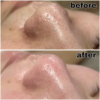 SHECIAお顔剃りシェービング専門店所属・お顔剃りエステサロン SHECIAのその他イメージ