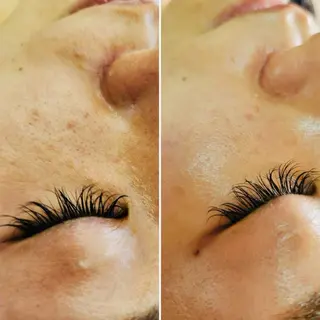 Anacia Beauty Salon所属・美肌脱毛&毛穴専門 Anaciaのエステ・リラクイメージ