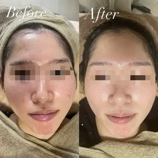 プライベートサロン Belle（ベル）のエステ・リラクイメージ