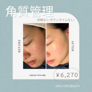 メンズ OPS×LIFE BEAUTY/maiのエステ・リラクイメージ