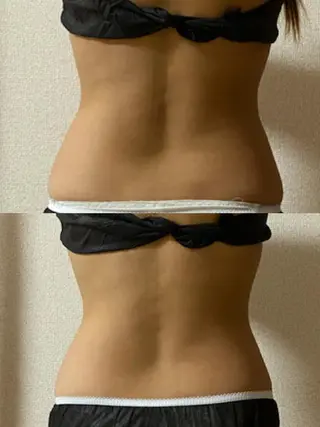 eye lash Lapisのマツエク・マツパデザイン