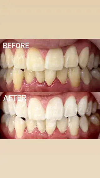 LBSホワイトニング 銀座店💎店長浦和のその他イメージ