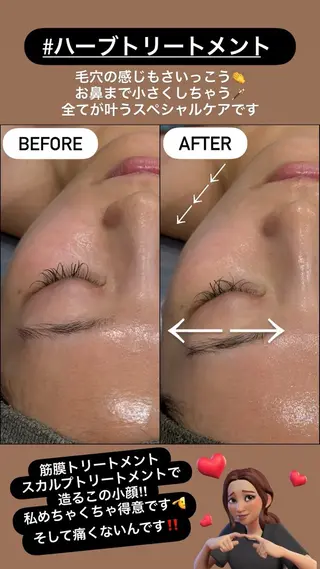 LiZA エステティックサロンのエステ・リラクイメージ