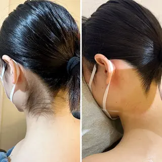 うなじ脱毛/美肌脱毛 LABELのエステ・リラクイメージ