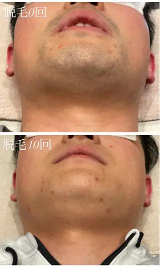 TotalBeautySalon UNCHEL所属・Ito ayakaのマツエク・マツパデザイン