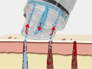 小顔・ツルツル素肌 ハリステリアのエステ・リラクイメージ