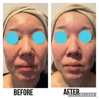 隠れ家フェイシャル&ドライヘッドケア新座所属・隠れ家フェイシャル＆ ドライヘッドケア新座のエステ・リラクイメージ