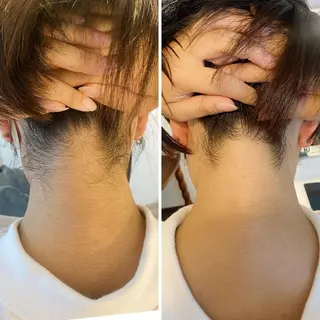 うなじ脱毛/美肌脱毛 LABELのエステ・リラクイメージ