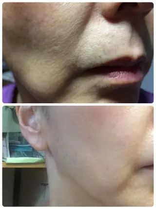 ビューティースタジオ DEWのエステ・リラクイメージ