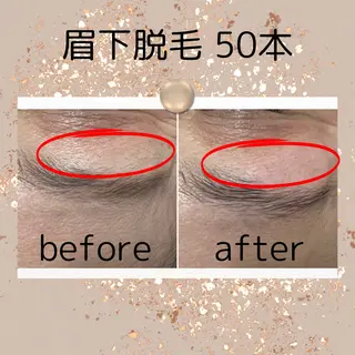 中庄駅前エステ BRILLAR小豆のヘアスタイル