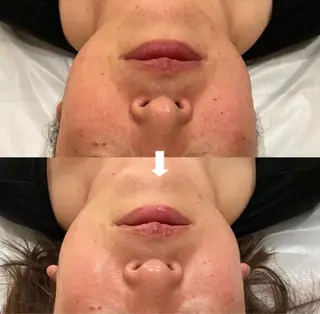 杉原 里奈のエステ・リラクイメージ