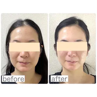 小顔矯正サロン　クレール所属・小顔矯正専門サロン クレールのエステ・リラクイメージ