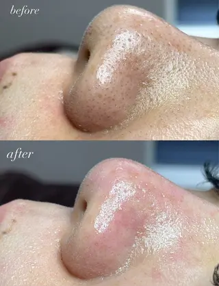 beautysalonW所属・beauty salonWのエステ・リラクイメージ