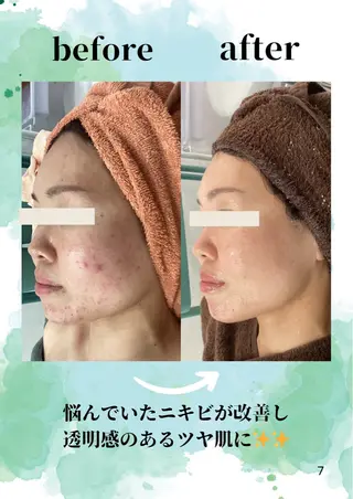 エステ♡Eden Asamiのエステ・リラクイメージ