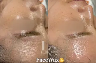 Le cherienのエステ・リラクイメージ