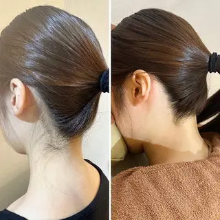 うなじ脱毛/美肌脱毛 LABELのエステ・リラクイメージ