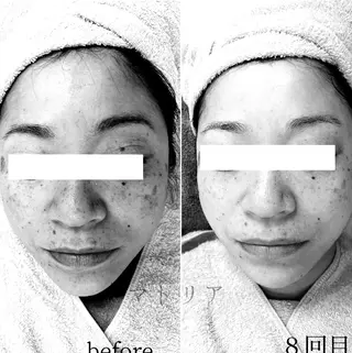 小顔と美肌 まごころエステMatoria所属・小顔 美肌専門 Matoriaのエステ・リラクイメージ