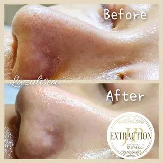 エステサロン　Lazulisea所属・川口 春奈のエステ・リラクイメージ