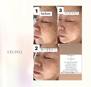 ルサンク所属・坂井 かおりのエステ・リラクイメージ