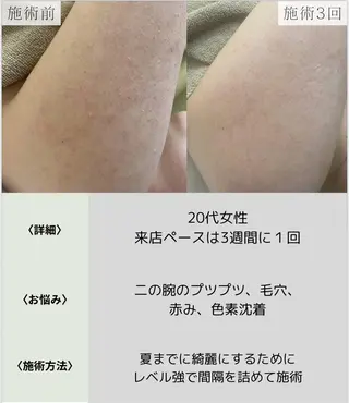 脱毛・眉毛・フェイス サロンN久留米店の眉毛・アイブロウイメージ