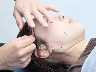 美容鍼・小顔矯正 FLOW 鍼灸整体院のその他イメージ