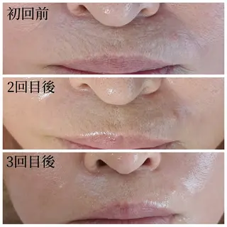 Salon de  HiAのエステ・リラクイメージ