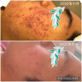 美肌蘇生カウンセラー 横山りえのエステ・リラクイメージ