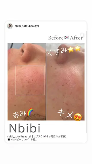 韓国🇰🇷価格 サロン_Nbibiのエステ・リラクイメージ