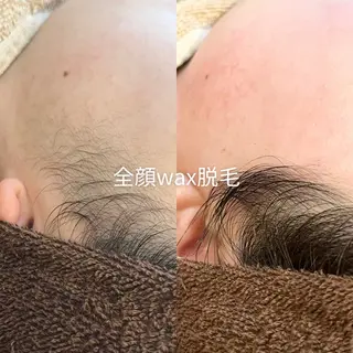 EST BEAUTY所属・顔ワックス脱毛/ ハーブピーリングのエステ・リラクイメージ