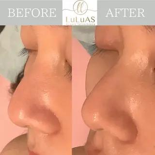 ルルアス GINZAのエステ・リラクイメージ