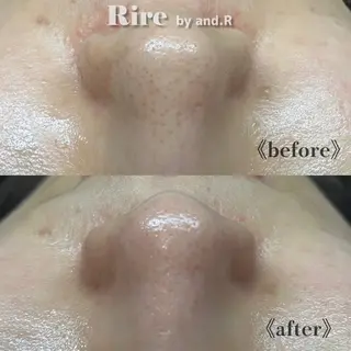 実方 梨々花のエステ・リラクイメージ