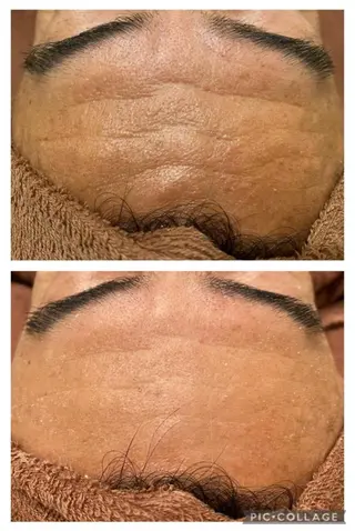 夏までに肌荒れ卒業 するサロン🌻のエステ・リラクイメージ