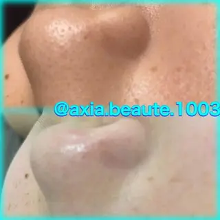 メンズ アクシア ビューティー サロン所属・究極のアンチエイ ジングサロンのエステ・リラクイメージ