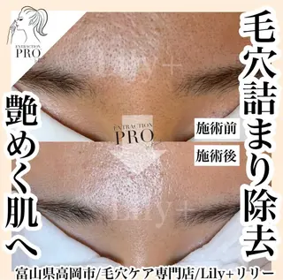 リリー yuriのエステ・リラクイメージ